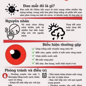 BÀI TUYÊN TRUYỀN BỆNH ĐAU MẮT ĐỎ